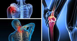 Thoát khỏi những cơn đau nhức xương khớp nhờ một số cây thuốc nam phổ biến 7