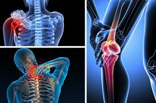 Thoát khỏi những cơn đau nhức xương khớp nhờ một số cây thuốc nam phổ biến 9