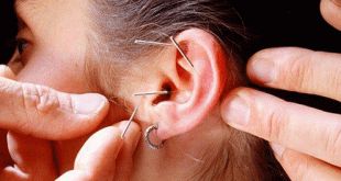 Đột phá y học cổ truyền chữa bệnh trên đôi vành tai bằng Nhĩ châm 1