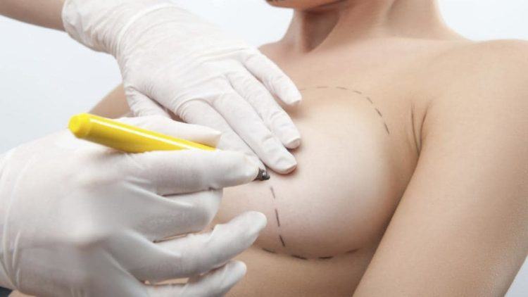7 cách chăm sóc ngực chảy xệ phụ nữ có con nên biết 7