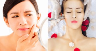 Làm đẹp tại nhà hay đi spa? Đừng dễ bị cám dỗ bởi quảng cáo! 13