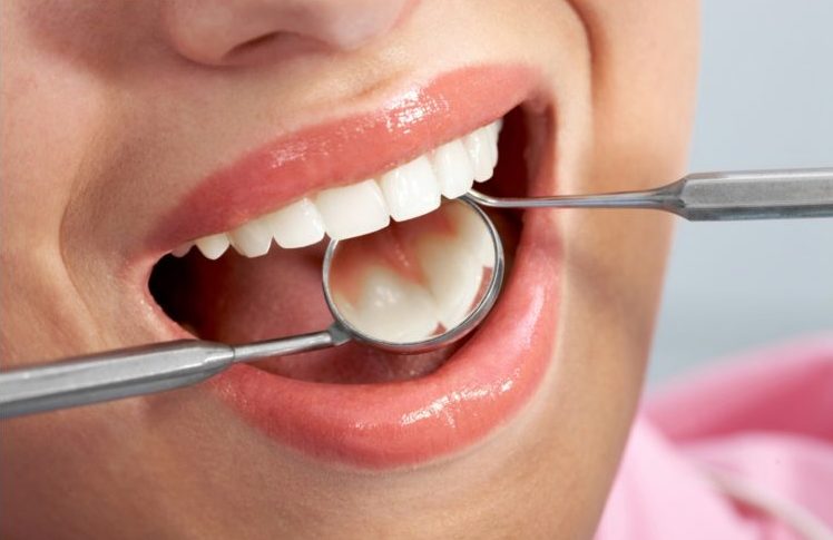 [Hỏi đáp nha sĩ] 8 câu hỏi phổ biến nhất về răng miệng 1
