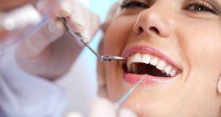 Cách phòng ngừa và xử lý khi bị mẻ răng 10