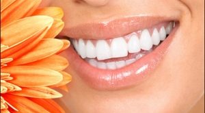 Top 5 Nguyên nhân khiến răng lung lay, rụng sớm và cách phòng ngừa