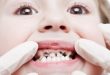 Top 8 Cách chữa sâu răng đơn giản và triệt để nhất