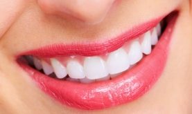 Top 9 Siêu thực phẩm cho hàm răng chắc khỏe nhất