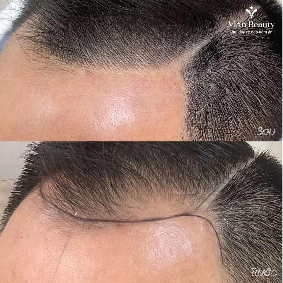 Review Vian Beauty: Điêu khắc sợi tóc có thực sự hiệu quả như lời đồn? 7