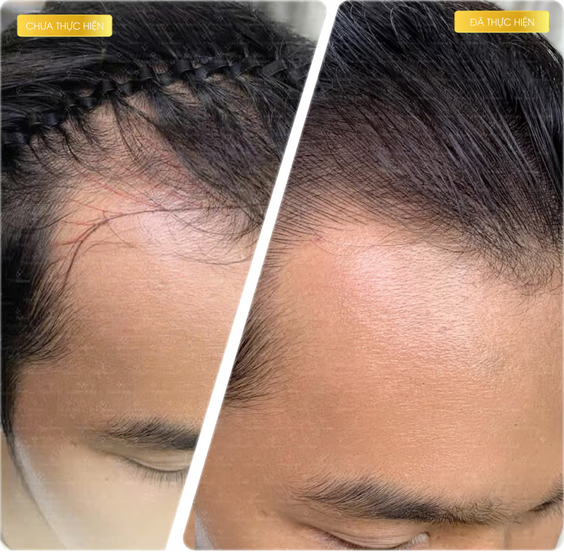 Review Vian Beauty: Điêu khắc sợi tóc có thực sự hiệu quả như lời đồn? 6