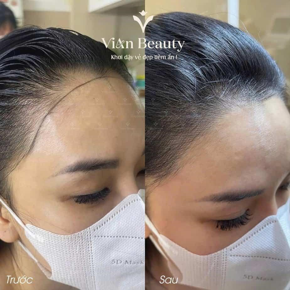 Review Vian Beauty: Điêu khắc sợi tóc có thực sự hiệu quả như lời đồn? 5